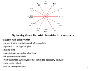 Fig showing the cardiac axis in hexaxial referrance system
causes of right axis deviation
•normal finding in children and tall thin adults
•right ventricular hypertrophy
•chronic lung
•anterolateral myocardial infarction
•left posterior hemiblock
•Wolff-Parkinson-White syndrome - left sided accessory pathway
•atrial septal defect
•ventricular septal defect 40
 