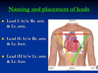 Ecg presentation | PDF