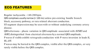 Ecg presentation | PDF