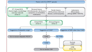 Ecg Electrocardiography Presentation Pptx