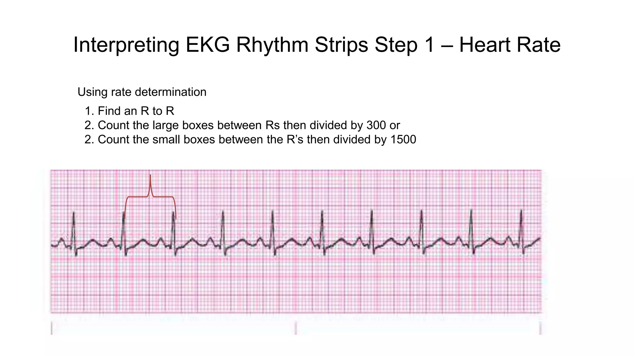 Ecg presentation1 | PPTX