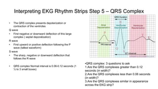 Downward Deflection Ecg presentation1 | PPTX
