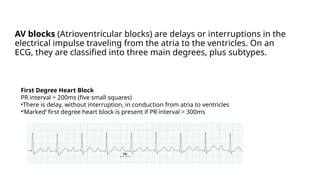 ecg primary care reference for medical professionals | PPTX