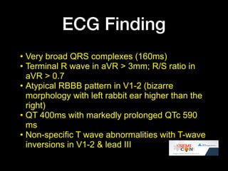 Ecg quiz @ SEMICON 1018 | PDF