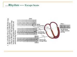 PowerPoint presentation of ECG Quick Reference.PPT