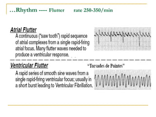 PowerPoint presentation of ECG Quick Reference.PPT