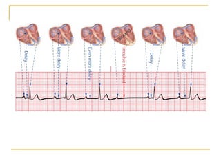 PowerPoint presentation of ECG Quick Reference.PPT