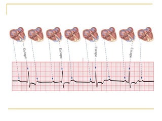 PowerPoint presentation of ECG Quick Reference.PPT