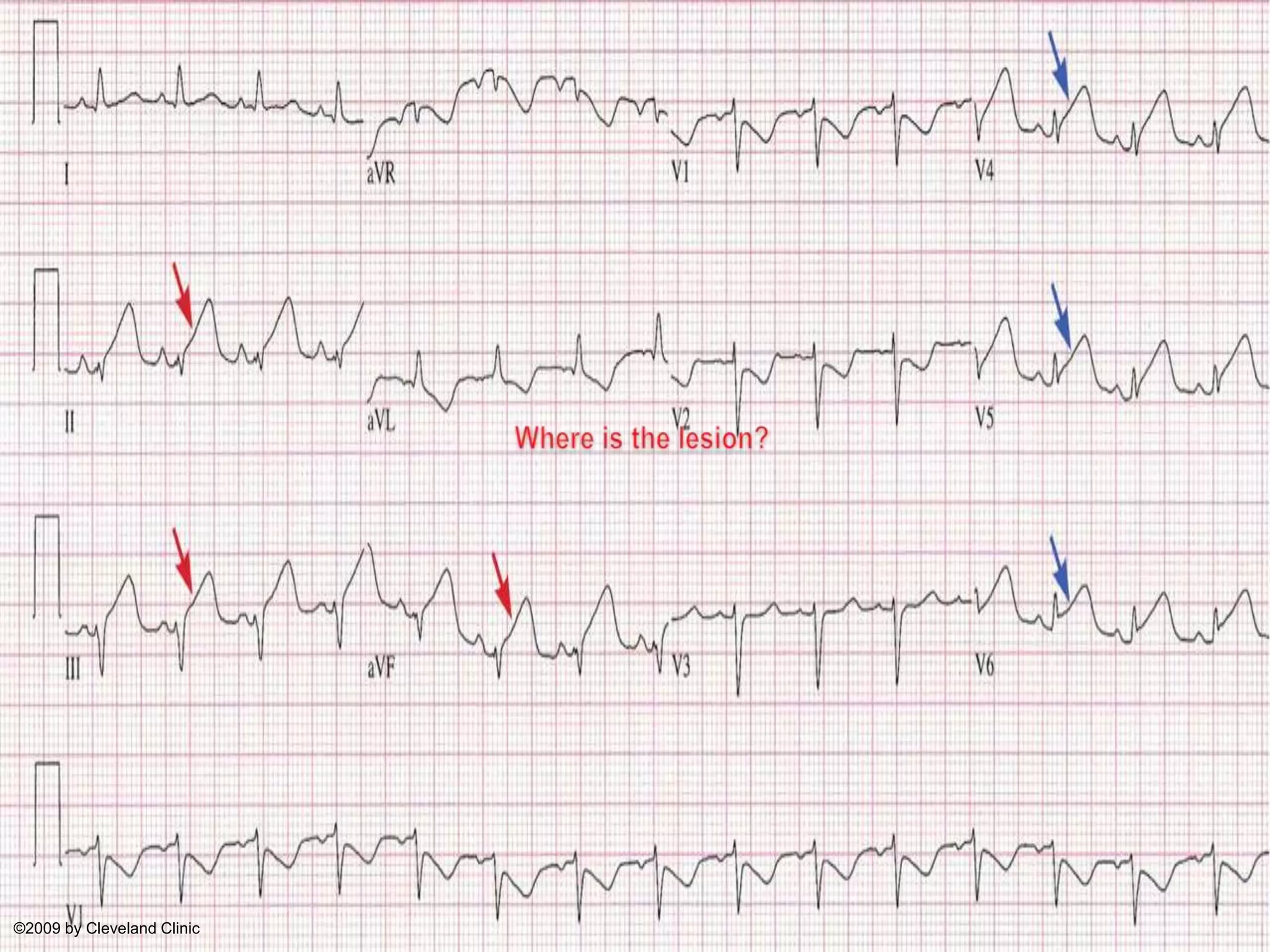 Where is the lesion?©2009 by Cleveland Clinic