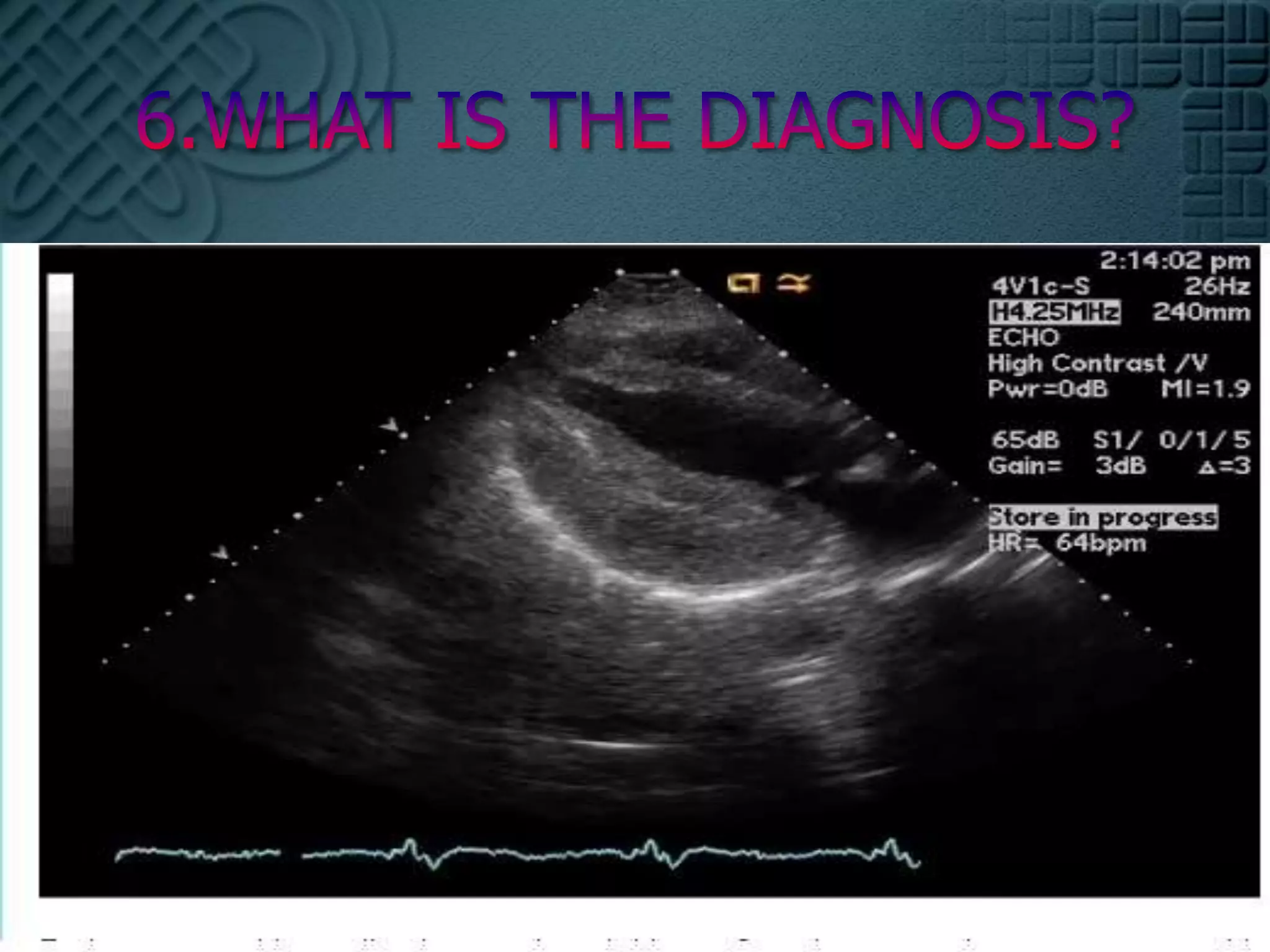 6.WHAT IS THE DIAGNOSIS? 