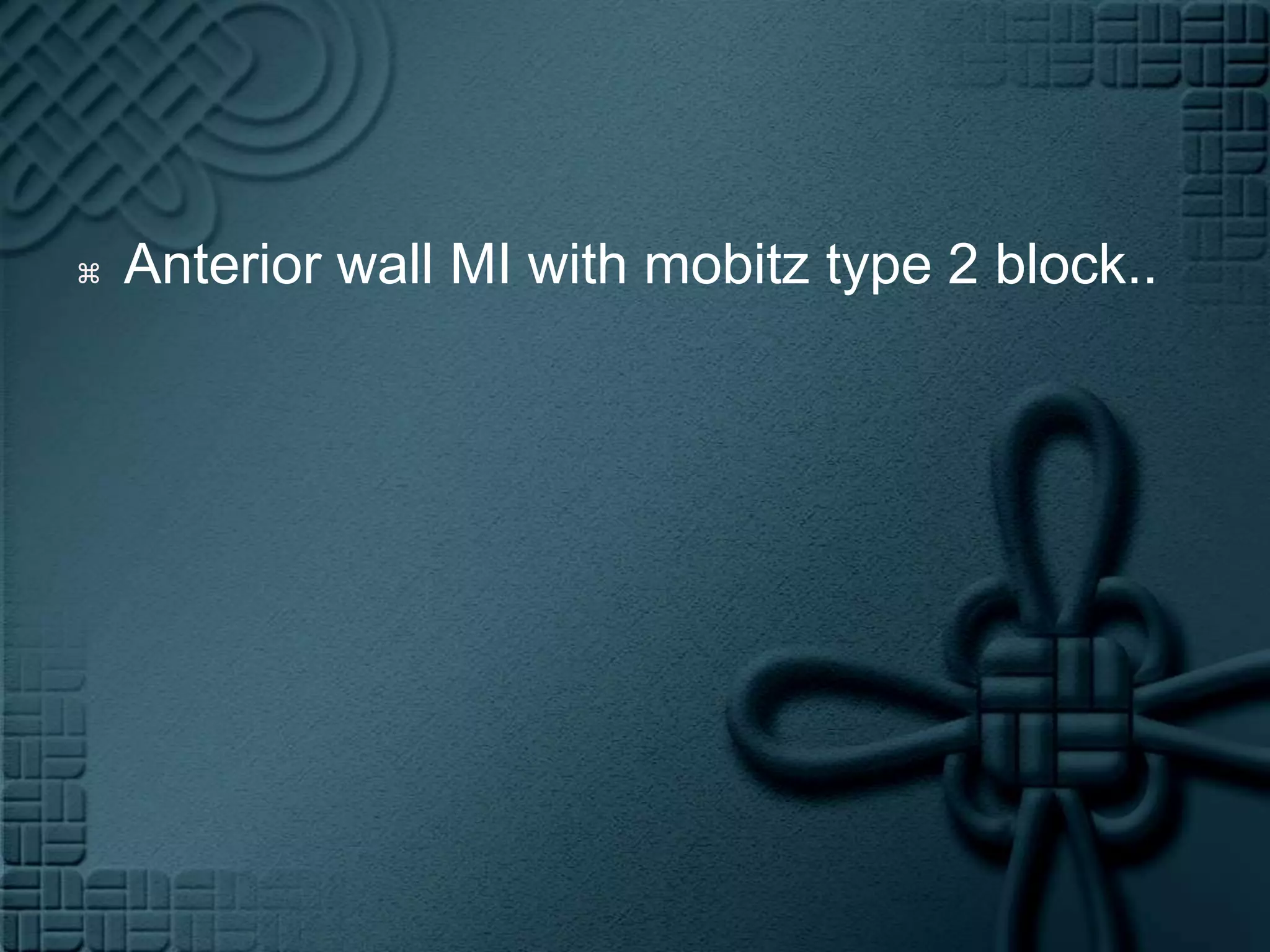 Anterior wall MI with mobitz type 2 block..