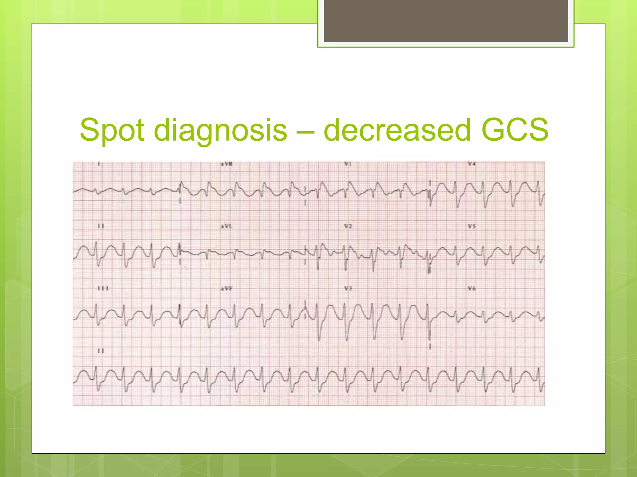 Spot diagnosis – decreased GCS
 
