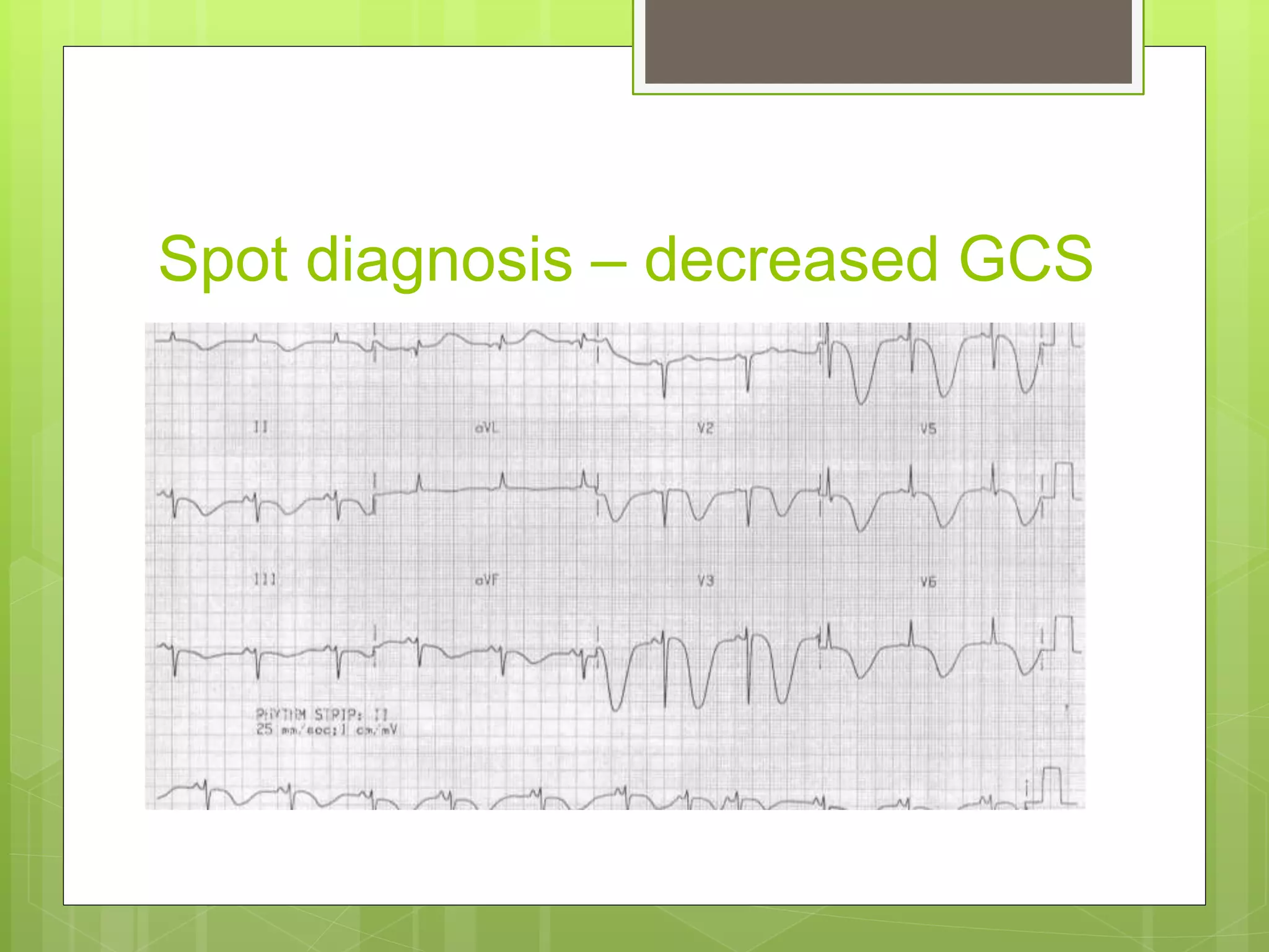 Spot diagnosis – decreased GCS
 