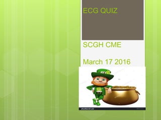 ECG QUIZ
SCGH CME
March 17 2016
 