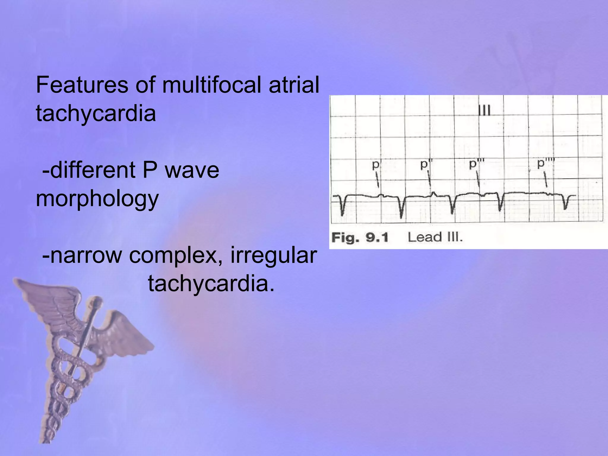 Features of multifocal atrial tachycardia -different P wave morphology -narrow complex, irregular  tachycardia. 