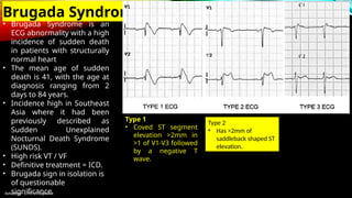 Reference : LITFL ST Segment
Brugada Syndrome
• Brugada Syndrome is an
ECG abnormality with a high
incidence of sudden death
in patients with structurally
normal heart
• The mean age of sudden
death is 41, with the age at
diagnosis ranging from 2
days to 84 years.
• Incidence high in Southeast
Asia where it had been
previously described as
Sudden Unexplained
Nocturnal Death Syndrome
(SUNDS).
• High risk VT / VF
• Definitive treatment = ICD.
• Brugada sign in isolation is
of questionable
significance.
Type 1
• Coved ST segment
elevation >2mm in
>1 of V1-V3 followed
by a negative T
wave.
Type 2
• Has >2mm of
saddleback shaped ST
elevation.
 