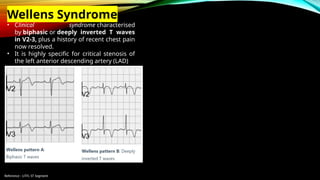 Reference : LITFL ST Segment
Wellens Syndrome
• Clinical syndrome characterised
by biphasic or deeply inverted T waves
in V2-3, plus a history of recent chest pain
now resolved.
• It is highly specific for critical stenosis of
the left anterior descending artery (LAD)
 