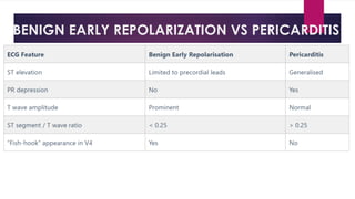 BENIGN EARLY REPOLARIZATION VS PERICARDITIS
 