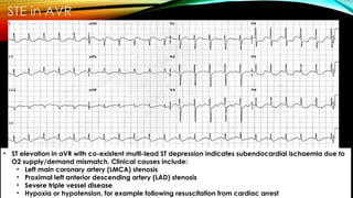 • ST elevation in aVR with co-existent multi-lead ST depression indicates subendocardial ischaemia due to
O2 supply/demand mismatch. Clinical causes include:
• Left main coronary artery (LMCA) stenosis
• Proximal left anterior descending artery (LAD) stenosis
• Severe triple vessel disease
• Hypoxia or hypotension, for example following resuscitation from cardiac arrest
STE in AVR
 