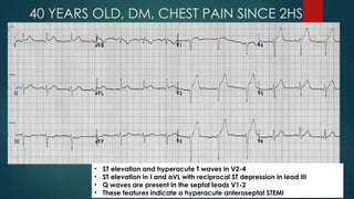 40 YEARS OLD, DM, CHEST PAIN SINCE 2HS
• ST elevation and hyperacute T waves in V2-4
• ST elevation in I and aVL with reciprocal ST depression in lead III
• Q waves are present in the septal leads V1-2
• These features indicate a hyperacute anteroseptal STEMI
 