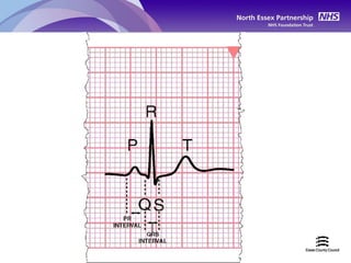 Ecg recording basic interpretation e learning 2 | PPT