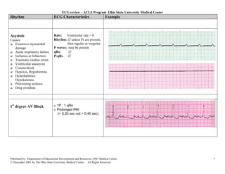 ECG review – ACLS Program Ohio State University Medical Center
Rhythm                            ECG Characteristics                      Example



Asystole                          Rate:   Ventricular rate = 0
Causes:                           Rhythm: ∅ unless Ps are present,
   Extensive myocardial                    then regular or irregular
   damage                         P waves: may be present
   Acute respiratory failure      qRs:      ∅
   Ischemia or Infarction         P:qRs ∅
   Traumatic cardiac arrest
   Ventricular aneurysm
   Countershock
   Hypoxia, Hypothermia
   Hyperkalemia,
   Hypokalemia
   Preexisting acidosis
   Drug overdose




1st degree AV Block               υ 1P : 1 qRs
                                  υ Prolonged PRI
                                    (> 0.20 sec not > 0.40 sec)




Published by: Department of Educational Development and Resources, OSU Medical Center                     7
© December 2001 by The Ohio State Univeristy Medical Center All Rights Reserved
 