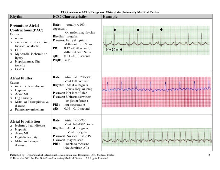 Ecg Rhythms Charex