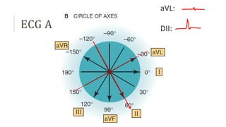ECG studenti explicat pe scurt fiziologie.pptx
