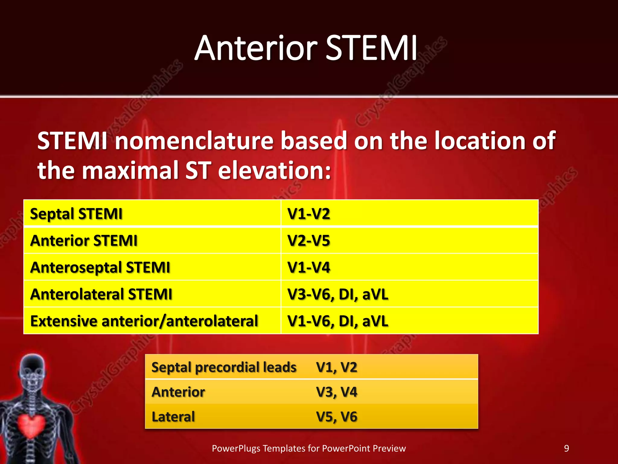 Anterior STEMI
STEMI nomenclature based on the location of
the maximal ST elevation:
PowerPlugs Templates for PowerPoint Preview 9
Septal STEMI V1-V2
Anterior STEMI V2-V5
Anteroseptal STEMI V1-V4
Anterolateral STEMI V3-V6, DI, aVL
Extensive anterior/anterolateral V1-V6, DI, aVL
Septal precordial leads V1, V2
Anterior V3, V4
Lateral V5, V6
 
