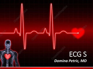 Domina Petric, MD
ECG S
 