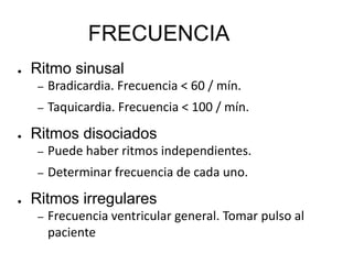 FRECUENCIARitmosinusal