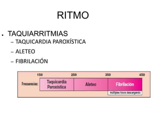 Puede haber ritmos independientes.