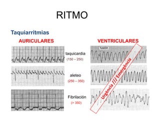 Determinar frecuencia de cada uno.