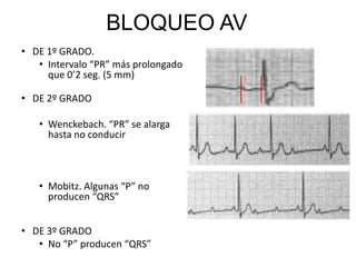 Frecuencia ventricular general. Tomar pulso al pacienteRITMOIdentificarritmobásico.
