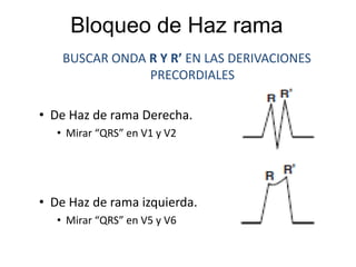 Realizarinspeccióntrazo largo