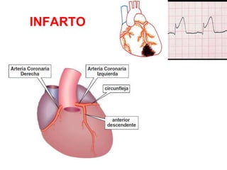 Verificar “P” antes de cada “QRS”