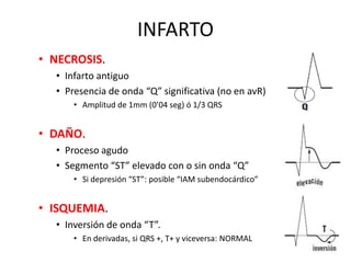 Medir intervalos “PR”