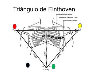 Triángulo de Einthoven