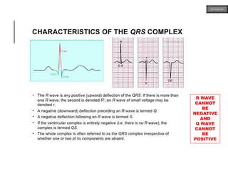 R WAVE
CANNOT
BE
NEGATIVE
AND
Q WAVE
CANNOT
BE
POSITIVE
ECG MADE EASY
 