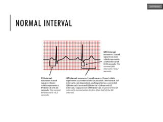 NORMAL INTERVAL
ECG MADE EASY
 