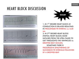 HEART BLOCK DISCUSSION
DOUBT
1. IN 1ST DEGREE HEART BLOCK AV
CONDUCTION IS DELAYED RESULTING
IN PROLONGED PR INTERVAL i.e. 0.20
sec.
2. IN 2ND DEGREE HEART BLOCK
(PARTIAL HEART BLOCK) SOME
IMPULSES FROM THE ATRIA FAILED TO
GET THROUGHTO THE VENTRICLES i.e.
DROPPED BEAT OCCURS.
SOMETIMES THERE IS
PROGRESSIVE LENGTHENING OF
SUCCESSIVE PR INTERVALS FOLLOWED
BY A DROPPED BEAT
ECG MADE EASY
 