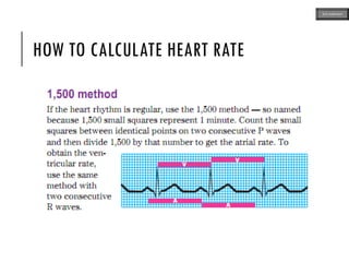 HOW TO CALCULATE HEART RATE
ECG MADE EASY
 