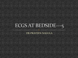 DR.PRAVEEN NAGULA ECGS AT BEDSIDE---5 