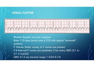 ECG Series on Other Parts of ECG as part of requirement | PDF