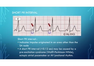 ECG Series on Other Parts of ECG as part of requirement | PDF
