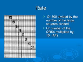 Rate
      Or 300 divided by the
      number of the large
      squares divided
     Or number of the
      QRSs multiplied by
      10 (AF)
 