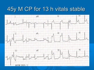 45y M CP for 13 h vitals stable
 