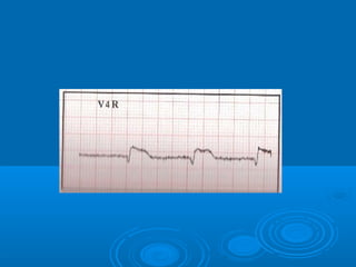 Ec gs  for medical student