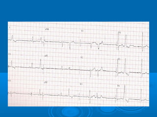 Ec gs  for medical student