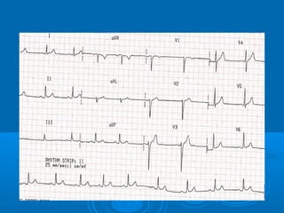 Ec gs  for medical student